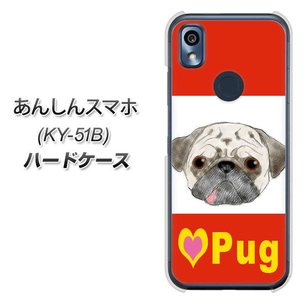 あんしんスマホ KY-51B docomo 高画質仕上げ 背面印刷 ハードケース【YD856 パグ02】