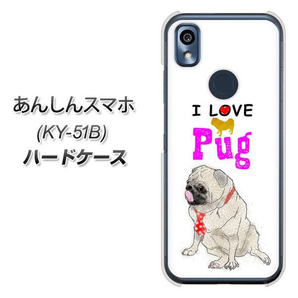 あんしんスマホ KY-51B docomo 高画質仕上げ 背面印刷 ハードケース【YD858 パグ04】