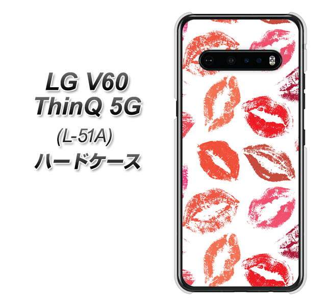 docomo LG V60 ThinQ 5G L-51A 高画質仕上げ 背面印刷 ハードケース【734 キスkissキス】