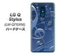 LG Q Stylus LM-Q710XM 高画質仕上げ 背面印刷 ハードケース【286 3D 音符】