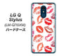 LG Q Stylus LM-Q710XM 高画質仕上げ 背面印刷 ハードケース【734 キスkissキス】