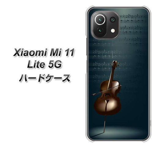 Xiaomi（シャオミ）Mi 11 Lite 5G 高画質仕上げ 背面印刷 ハードケース【441 楽譜】