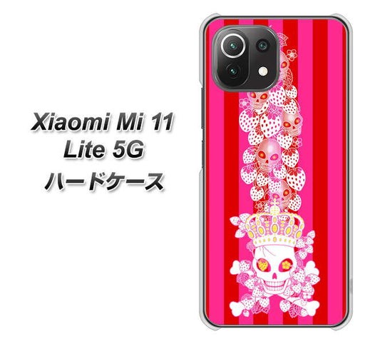 Xiaomi（シャオミ）Mi 11 Lite 5G 高画質仕上げ 背面印刷 ハードケース【AG803 苺骸骨王冠蔦（ピンク）】