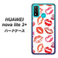 HUAWEI（ファーウェイ） nova lite 3プラス POT-LX2J 高画質仕上げ 背面印刷 ハードケース【734 キスkissキス】