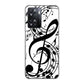 OPPO A77 高画質仕上げ 背面印刷 ハードケース【260 あふれる音符】