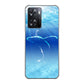 OPPO A77 高画質仕上げ 背面印刷 ハードケース【1047 海の守り神くじら】