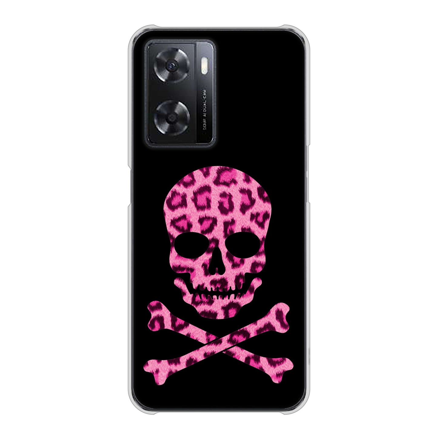OPPO A77 高画質仕上げ 背面印刷 ハードケース【1079 ドクロフレームヒョウピンク】
