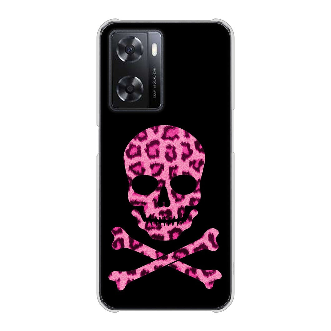 OPPO A77 高画質仕上げ 背面印刷 ハードケース【1079 ドクロフレームヒョウピンク】