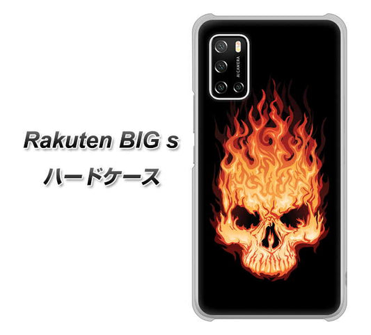 楽天モバイル Rakuten BIGs 高画質仕上げ 背面印刷 ハードケース【364 ドクロの怒り】