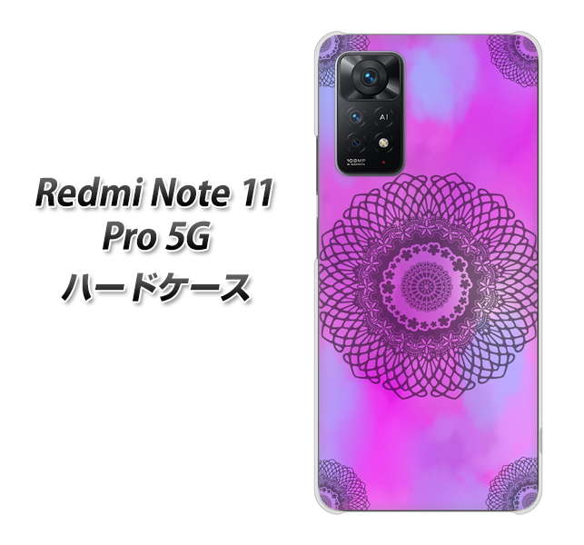 Redmi Note 11 Pro 5G 高画質仕上げ 背面印刷 ハードケース【YJ344 レース】