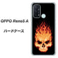 SIMフリー オッポ Reno5 A 高画質仕上げ 背面印刷 ハードケース【364 ドクロの怒り】