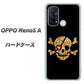 SIMフリー オッポ Reno5 A 高画質仕上げ 背面印刷 ハードケース【1082 海賊ドクロ】