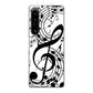 Xperia 1 V SOG10 au 高画質仕上げ 背面印刷 ハードケース音符