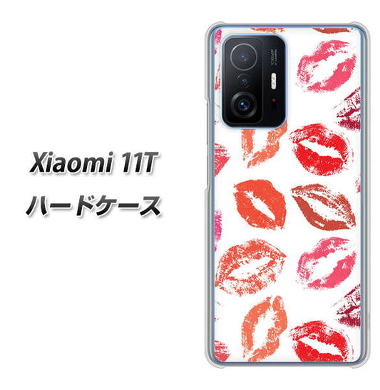 Xiaomi 11T 高画質仕上げ 背面印刷 ハードケース【734 キスkissキス】