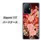Xiaomi 11T 高画質仕上げ 背面印刷 ハードケース【VA824 魅惑の蝶とピンクのバラ】