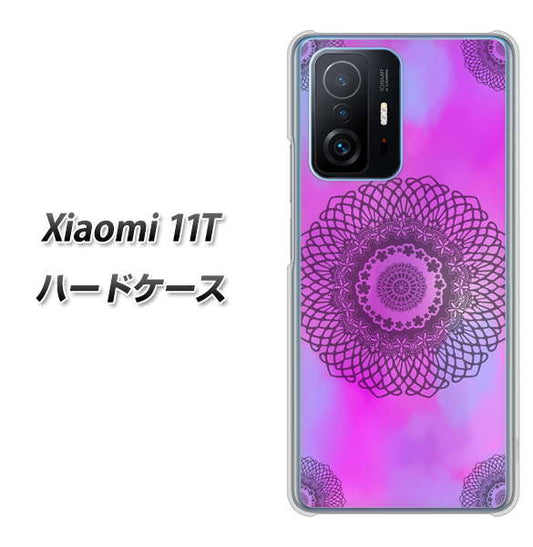 Xiaomi 11T 高画質仕上げ 背面印刷 ハードケース【YJ344 レース】