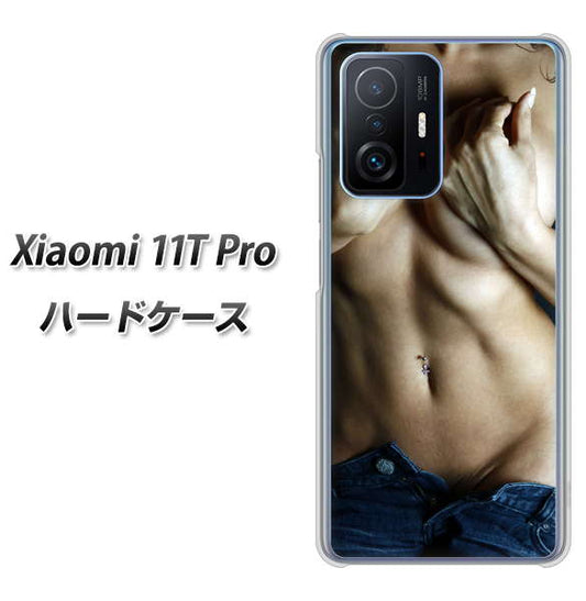 Xiaomi 11T Pro 高画質仕上げ 背面印刷 ハードケース【602 ボディライン】