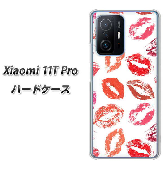 Xiaomi 11T Pro 高画質仕上げ 背面印刷 ハードケース【734 キスkissキス】