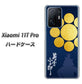 Xiaomi 11T Pro 高画質仕上げ 背面印刷 ハードケース【AB816 片倉小十郎 シルエットと家紋】