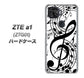 au ZTE a1 ZTG01 高画質仕上げ 背面印刷 ハードケース【260 あふれる音符】